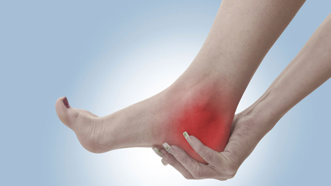 San Ramon Chiropractic Treatment for Plantar Fasciitis